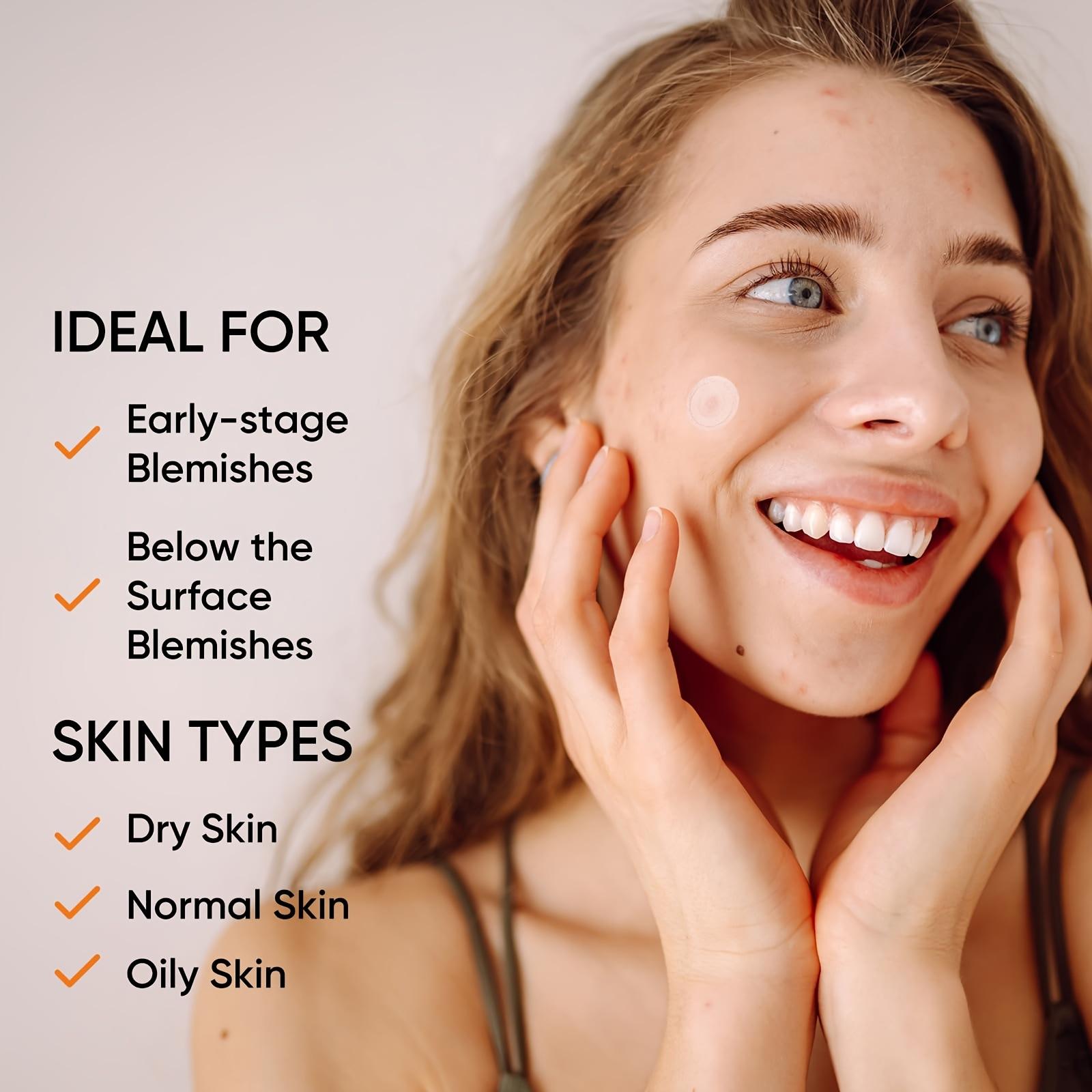 Large Hydrogel Acne Patches Xl – обзор и цена Xl Skincare