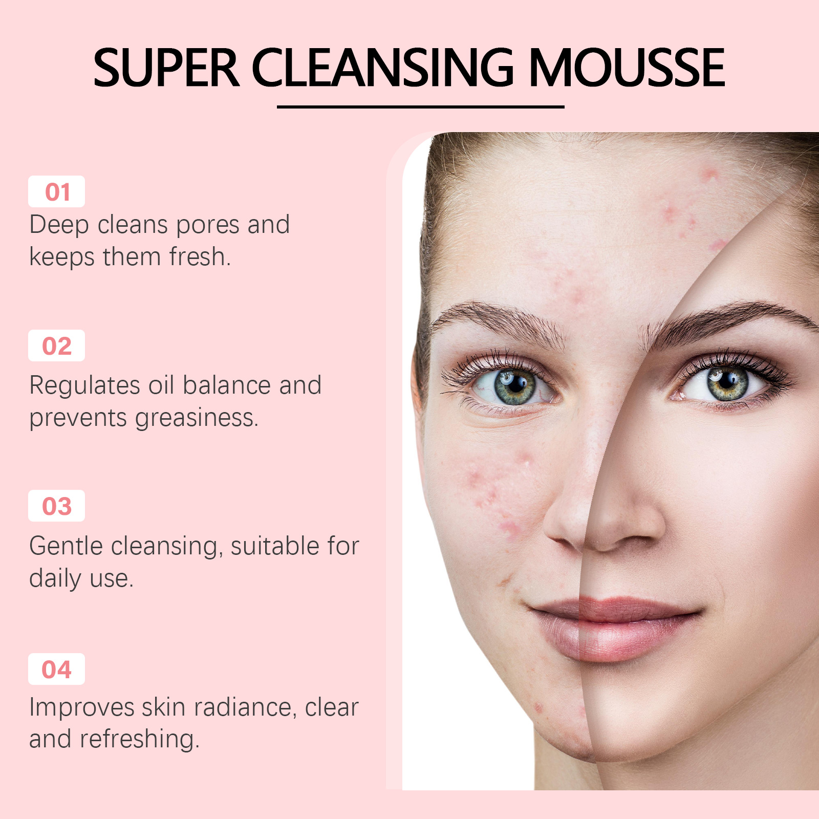 Facial Cleanser Mousse Moistur – обзор и цена Skincare Acne