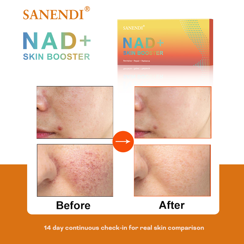 Sanendi NAD+ Korea Skincare Pr – обзор и цена Skincare Acne