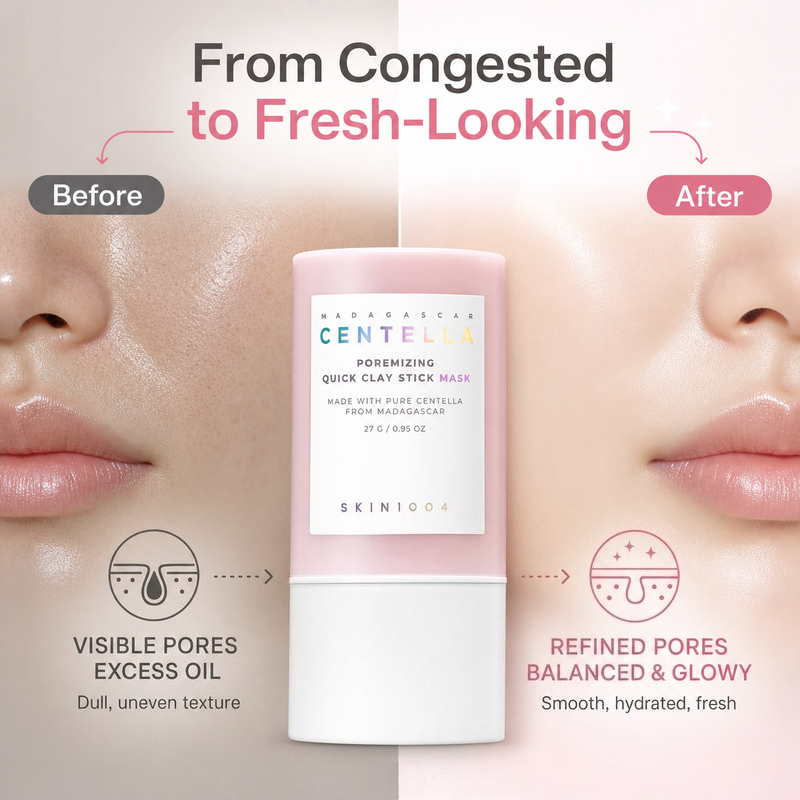 Korean Skincare Centella Porem – обзор и цена Skincare Acne