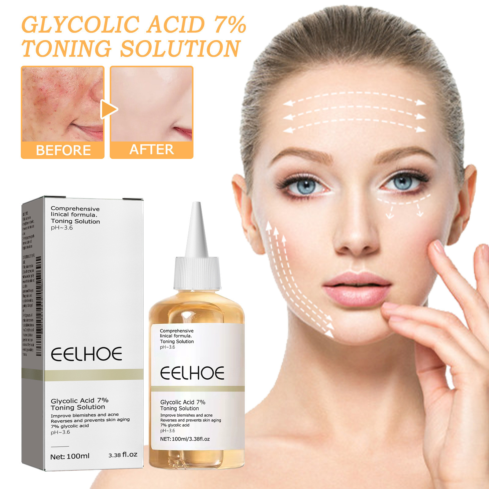 Ethanol Acid Toner for Removin – обзор и цена Skincare Acne