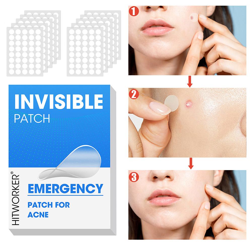400/800/1200pcs Acne Patches S – обзор и цена Skincare Acne