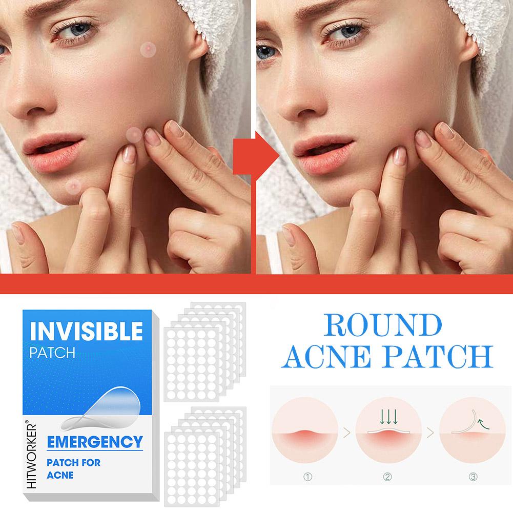 400/800/1200pcs Acne Patches S – обзор и цена Skincare Acne